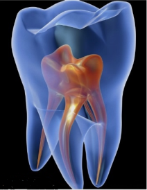 endodonzia termoli